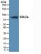 Integrin Subunit Beta 5 antibody, LS-C314893, Lifespan Biosciences, Western Blot image 