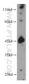 SET And MYND Domain Containing 3 antibody, 12011-1-AP, Proteintech Group, Western Blot image 