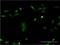 Casein Kinase 1 Epsilon antibody, H00001454-M07, Novus Biologicals, Immunocytochemistry image 