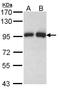 Gelsolin antibody, LS-B4801, Lifespan Biosciences, Western Blot image 