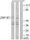 Zinc Finger And SCAN Domain Containing 26 antibody, A30500, Boster Biological Technology, Western Blot image 