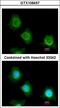 Platelet Factor 4 Variant 1 antibody, LS-C185989, Lifespan Biosciences, Immunocytochemistry image 