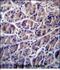 Calpain 8 antibody, PA5-48518, Invitrogen Antibodies, Immunohistochemistry frozen image 