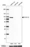 Cytoplasmic dynein 1 intermediate chain 2 antibody, HPA040619, Atlas Antibodies, Western Blot image 