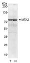 Metastasis-associated protein MTA2 antibody, A300-395A, Bethyl Labs, Western Blot image 