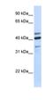 Hyaluronidase 1 antibody, orb330625, Biorbyt, Western Blot image 