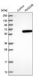 RAD23 Homolog B, Nucleotide Excision Repair Protein antibody, NBP1-89698, Novus Biologicals, Western Blot image 