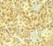 Vezatin, Adherens Junctions Transmembrane Protein antibody, NBP2-82044, Novus Biologicals, Immunohistochemistry paraffin image 