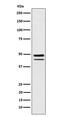 T antibody, M31984-1, Boster Biological Technology, Western Blot image 