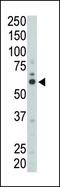 FYN Proto-Oncogene, Src Family Tyrosine Kinase antibody, PA5-14780, Invitrogen Antibodies, Western Blot image 