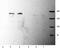 Glutamate Ionotropic Receptor NMDA Type Subunit 2B antibody, ab28373, Abcam, Western Blot image 