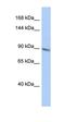 TBC1 Domain Family Member 2B antibody, orb324446, Biorbyt, Western Blot image 