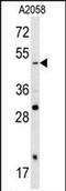 SRY-Box 4 antibody, PA5-72163, Invitrogen Antibodies, Western Blot image 