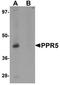 Proline Rich 5 antibody, orb75603, Biorbyt, Western Blot image 