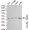 SET And MYND Domain Containing 2 antibody, MBS475114, MyBioSource, Western Blot image 