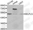 Selectin P Ligand antibody, A1660, ABclonal Technology, Western Blot image 