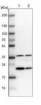 Glucosamine-Phosphate N-Acetyltransferase 1 antibody, NBP1-83842, Novus Biologicals, Western Blot image 
