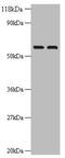 Inosine Monophosphate Dehydrogenase 2 antibody, A57797-100, Epigentek, Western Blot image 