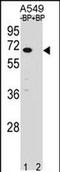 Ankyrin Repeat And SOCS Box Containing 3 antibody, PA5-71961, Invitrogen Antibodies, Western Blot image 