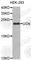 Urocortin antibody, A3647, ABclonal Technology, Western Blot image 