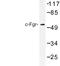 FGR Proto-Oncogene, Src Family Tyrosine Kinase antibody, LS-C176725, Lifespan Biosciences, Western Blot image 