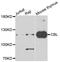Cbl Proto-Oncogene antibody, A7881, ABclonal Technology, Western Blot image 