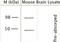 Transient Receptor Potential Cation Channel Subfamily V Member 4 antibody, NBP1-20225, Novus Biologicals, Western Blot image 