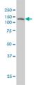 Laminin subunit beta-3 antibody, H00003914-M01, Novus Biologicals, Western Blot image 