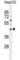 Spermidine/Spermine N1-Acetyl Transferase Like 1 antibody, abx026053, Abbexa, Western Blot image 