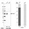 Transmembrane Protein 51 antibody, NBP2-55450, Novus Biologicals, Western Blot image 