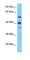 VPS33B Interacting Protein, Apical-Basolateral Polarity Regulator, Spe-39 Homolog antibody, orb327386, Biorbyt, Western Blot image 