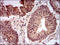 Abhydrolase Domain Containing 5 antibody, orb330242, Biorbyt, Immunohistochemistry paraffin image 