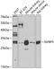 Insulin Like Growth Factor Binding Protein 5 antibody, 14-433, ProSci, Western Blot image 