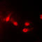 Casein Kinase 1 Epsilon antibody, LS-C352053, Lifespan Biosciences, Immunofluorescence image 