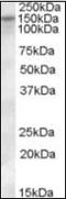Solute Carrier Family 12 Member 4 antibody, orb88156, Biorbyt, Western Blot image 