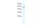 Sphingomyelin Phosphodiesterase Acid Like 3B antibody, PA5-40798, Invitrogen Antibodies, Western Blot image 