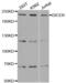 Dicer 1, Ribonuclease III antibody, abx004629, Abbexa, Western Blot image 