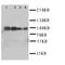 Transforming Growth Factor Beta Receptor 1 antibody, orb76244, Biorbyt, Western Blot image 