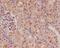 Cyclin Dependent Kinase Inhibitor 1C antibody, M01244-1, Boster Biological Technology, Immunohistochemistry paraffin image 