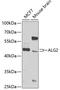 ALG2 Alpha-1,3/1,6-Mannosyltransferase antibody, GTX32432, GeneTex, Western Blot image 