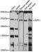 Extra Spindle Pole Bodies Like 1, Separase antibody, A15366, ABclonal Technology, Western Blot image 