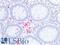 Caudal Type Homeobox 2 antibody, LS-C34664, Lifespan Biosciences, Immunohistochemistry paraffin image 