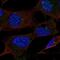 Ubiquitin-conjugating enzyme E2 Q1 antibody, NBP2-49394, Novus Biologicals, Immunocytochemistry image 