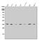 Solute Carrier Family 25 Member 1 antibody, A05995-2, Boster Biological Technology, Western Blot image 