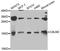 Calmodulin antibody, A8008, ABclonal Technology, Western Blot image 