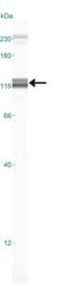 Lysine Demethylase 1A antibody, NB100-1762, Novus Biologicals, Western Blot image 