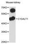 Core 1 Synthase, Glycoprotein-N-Acetylgalactosamine 3-Beta-Galactosyltransferase 1 antibody, STJ114731, St John