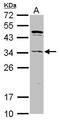 Ankyrin Repeat And SOCS Box Containing 8 antibody, GTX117973, GeneTex, Western Blot image 