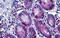 Kinesin Family Member C1 antibody, MBS245726, MyBioSource, Immunohistochemistry frozen image 