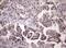 Late Cornified Envelope Like Proline Rich 1 antibody, M18211, Boster Biological Technology, Immunohistochemistry paraffin image 